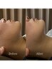 【筋膜集中ケア】顔深部からゆるめるヘッドスパ＋肩首集中オイルケア　80分