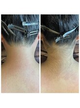 ココリ(CoCoRe)/うなじMIX脱毛&背中上半分WAX