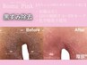 赤ちゃんの頃の色に戻す【ローマピンク】V /I /O　モニター¥275000→¥165,000