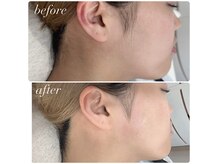 ウィンク(WINK)の雰囲気（フェイスワックスで産毛除去と角質ケア！驚くほどツヤ肌に♪）