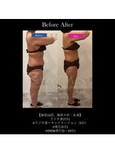 ベレピ(belepi)/やっぱりやるなら全身2時間！