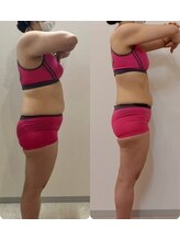 骨盤ダイエット専門サロン【骨盤ちゃん】ガーデン前橋店/Before/After/サイズダウン