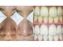 ニコ ホワイトニング 扶桑(Nico Whitening fuso)の雰囲気(毛穴エクストラクションプロ上級認定サロン/長年の毛穴悩み解決)