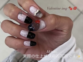 持ち込み/マグネット/パラジェル