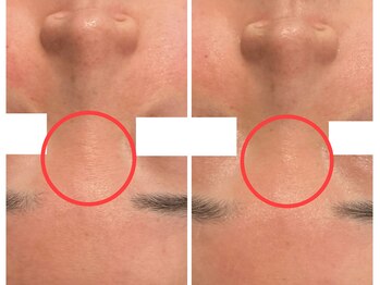 チェンジ(Change)/