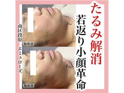 エミュローズ 段原店(Nm' Rose)の写真