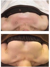 アンド ユー(and.yu)/★お客様症例★