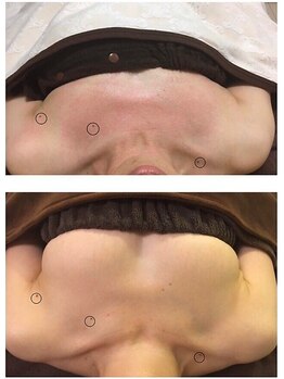 アンド ユー(and.yu)/★お客様症例★