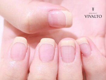 ワールド ビューティ ヴィヴァルト 宝塚店(WORLD BEAUTY VIVALTO)/スクエア/フレンチネイル