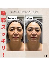 きれい塾 恵比寿/1回の施術結果