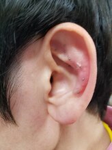 ビールーム 赤羽店(B-ROOM)/耳ツボ・耳つぼシール（チタン）