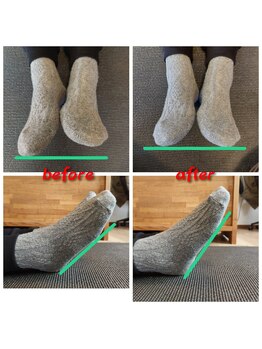 スロース(Sloth)/足首の角度バッチリ