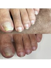 リリ(lili)/フットケア/ネイルケア