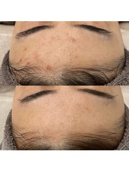 ヴェルシック(Belchic)/もう前髪でおでこを隠す必要なし