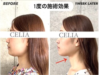 セリア(CELIA)