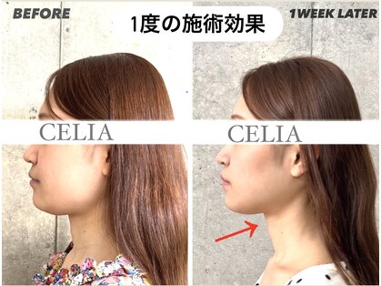 セリア(CELIA)の写真