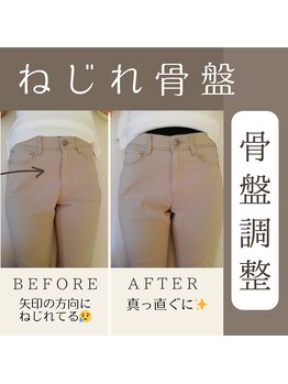 小竹向原ストレッチ整体院/ねじれた骨盤を矯正!