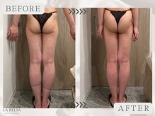 エステティックサロン ラ ベルタ(Esthetic Salon La Belta)/美骨ケア+セルライトゼロ3回
