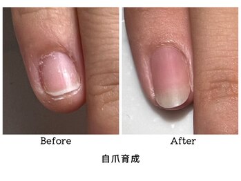 アンベリール(embellir.)/自爪育成