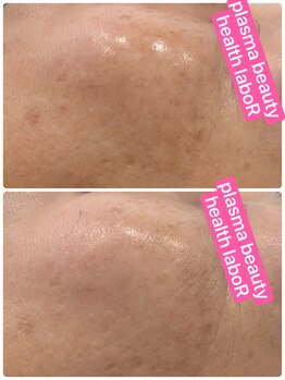 アール(R)/【 タラソトリートメント】