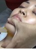 【部分Wax脱毛】気になるお顔1部分をWax脱毛で綺麗に★