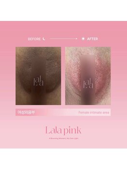 カルム(Calme)/Lalapink