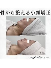 ソルヴィス(SOLVIS)/