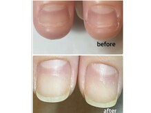 ミリアネイル 成城(Miliea nail)の雰囲気（深爪さんも育成でこんなに綺麗に爪を伸ばせます♪）