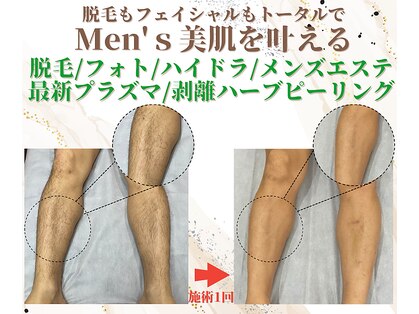 メンズミーシェ(Men's Meshie)の写真