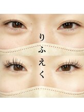 フォーヴリュンヌ(FOVLUNE)/ラッシュリフトとマツエク