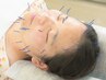 ☆口コミ投稿限定☆【フェイシャル美容鍼】30分　5000→4500