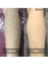 ラフルール(LA FLEUR)/