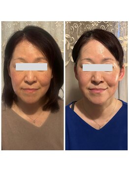 すなお 溝の口(Sunao)/【小顔コルギ】60代お客様