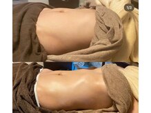 アイビー(ivy)/HOT腸もみ