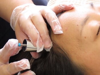 整骨院トリデ(整骨院TORIDE)/髪が薄くなってきたとお悩みの方