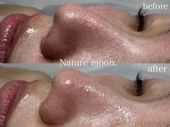 ナチュールムーン(Nature moon.)/毛穴洗浄
