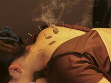 森の鍼灸院 京都下京町家院