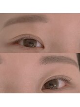 ジョリー(Jolie)/人気の形は