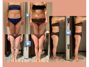 ボディスタイリング(Body Styling)/一度で実感＆継続で定着♪