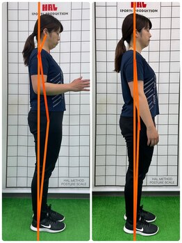 スタイル鍼灸整骨院/姿勢解析BeforeAfter