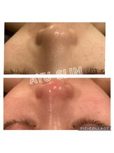 アユスリム(AYU SLIM)/毛穴ケアをしたい