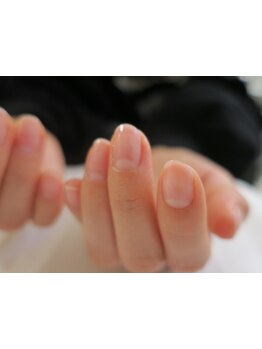 爪の悩みを解消できる（ケア含む）