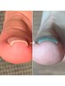 お試し◆巻爪緩和しながらフットジェル◆ワンカラー