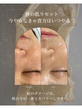 ヒュウ(hue.)/韓国発最新肌管理[セルマン]