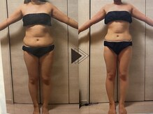 ヨサパーク リアン(YOSA PARK Lien)/モニター様before→after/痩身