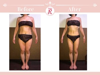 サロン アール(Salon R)/痩身施術×食事・インナーケア