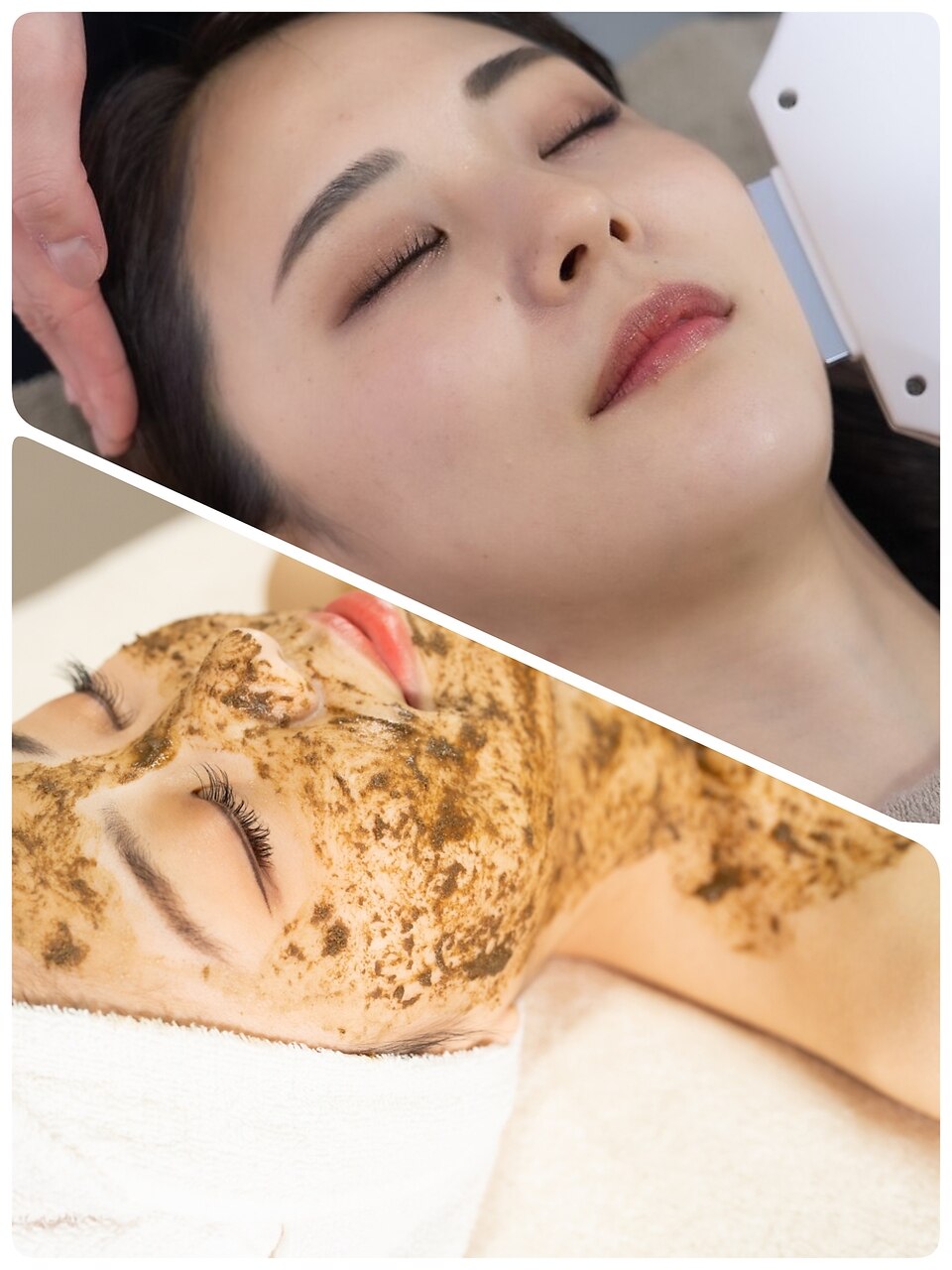 【ハーブ脱毛】美肌トリートメント全身脱毛+艶肌ハーブピーリングset 12000円