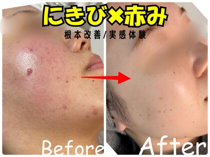 エレ(ele)の写真