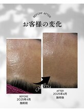 カリスティア(CARISTIA)/キメを整える