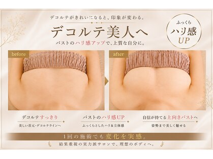 ミオ(MIO)の写真
